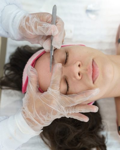 Dermaplaning